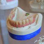 Prosthodontist Services